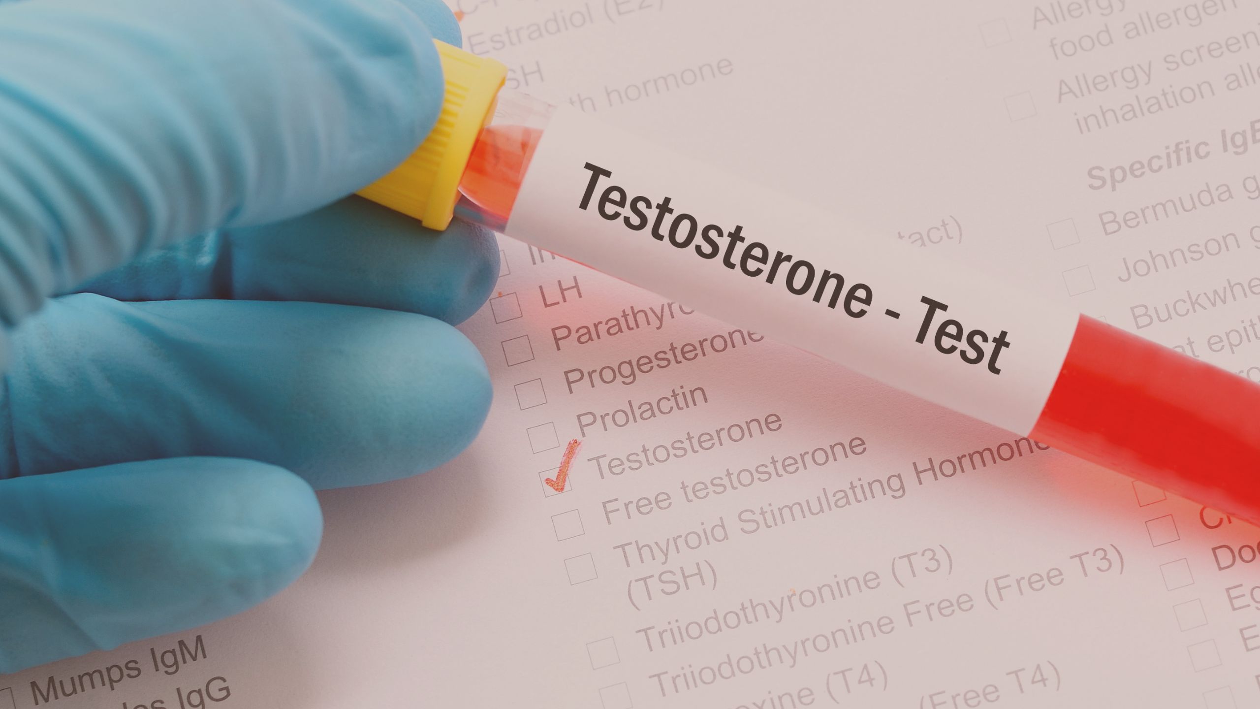 Testosterona Baixa: Sintomas, Causas e Quando Procurar Ajuda